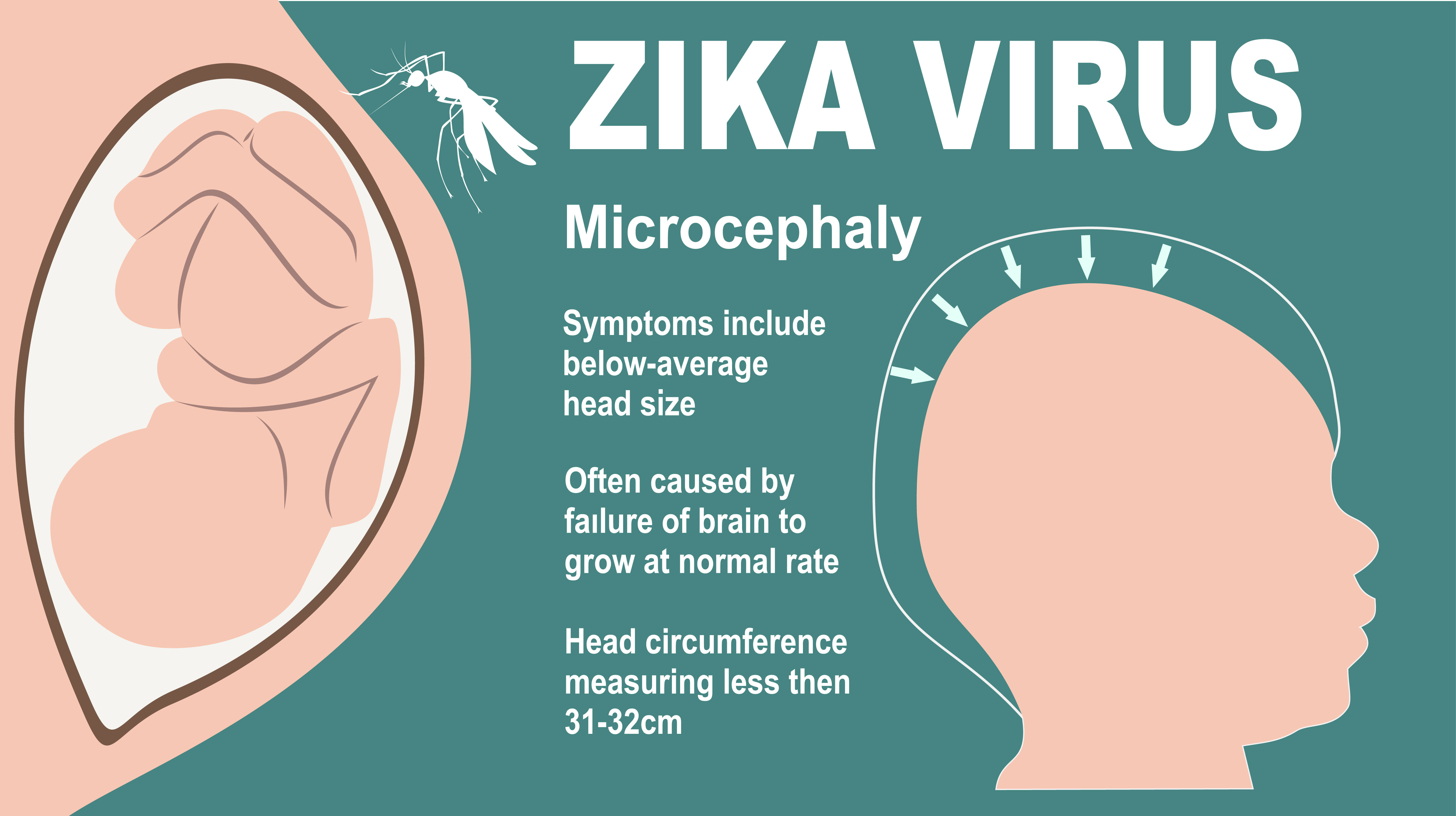 Zika And Pregnancy Symptoms Effects And Prevention 