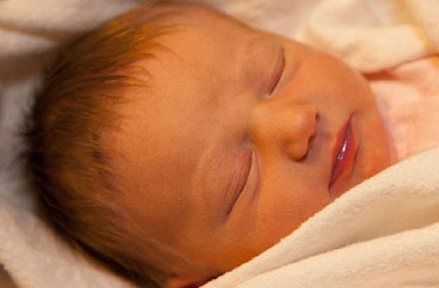 Jaundice in newborn